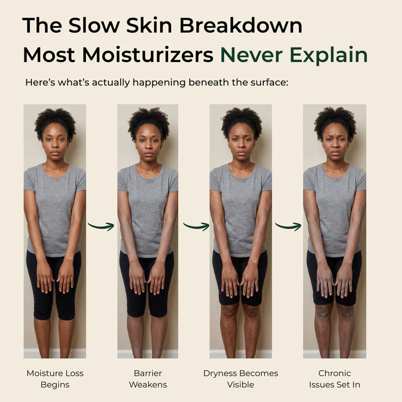 Pure Nilotica Shea Butter by Elevare™