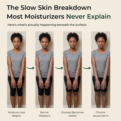 Pure Nilotica Shea Butter by Elevare™