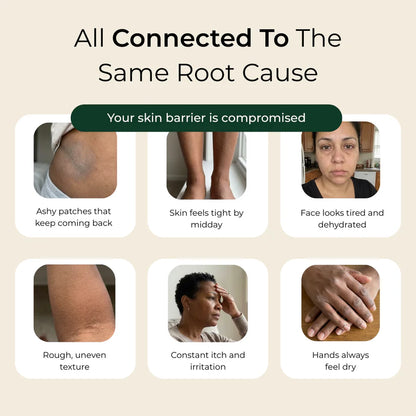 Pure Nilotica Shea Butter by Elevare™