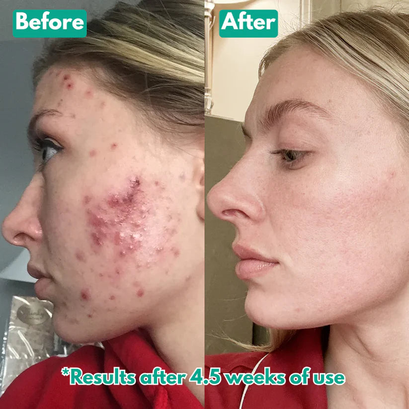 Microcrystal™ Serum PM Duo