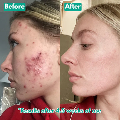 Microcrystal™ Serum PM Duo