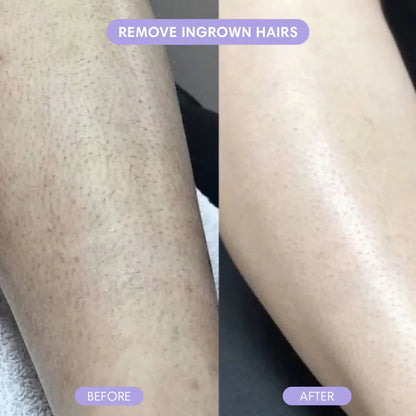 Smoothé — Body Hair Removal Spray