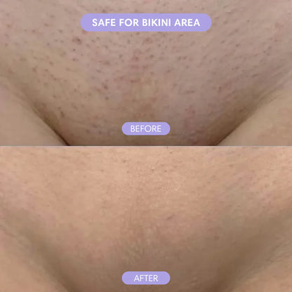 Smoothé — Body Hair Removal Spray