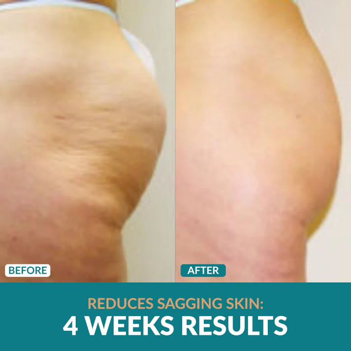 Anti-Cellulite Oil