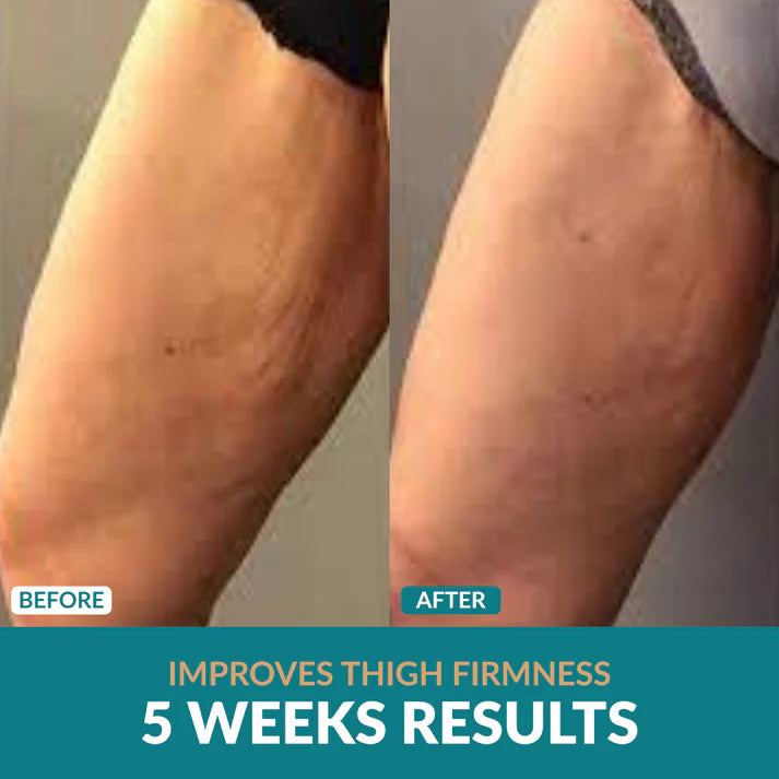 Anti-Cellulite Oil