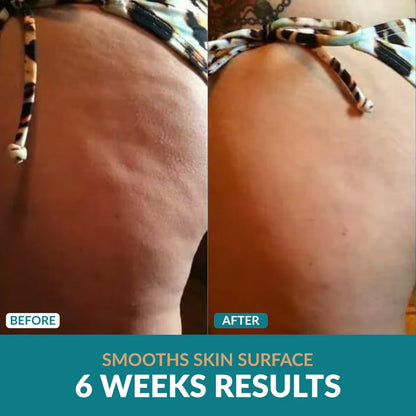 Anti-Cellulite Oil
